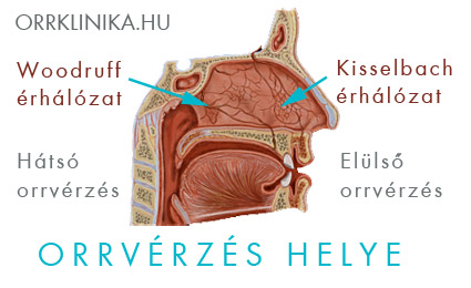 az ember miért szenved magas vérnyomásban